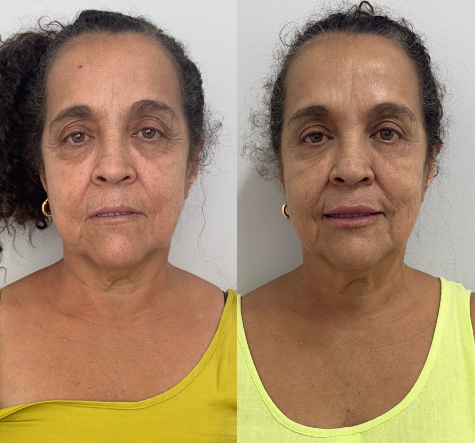 Resultado de Bioestimulador