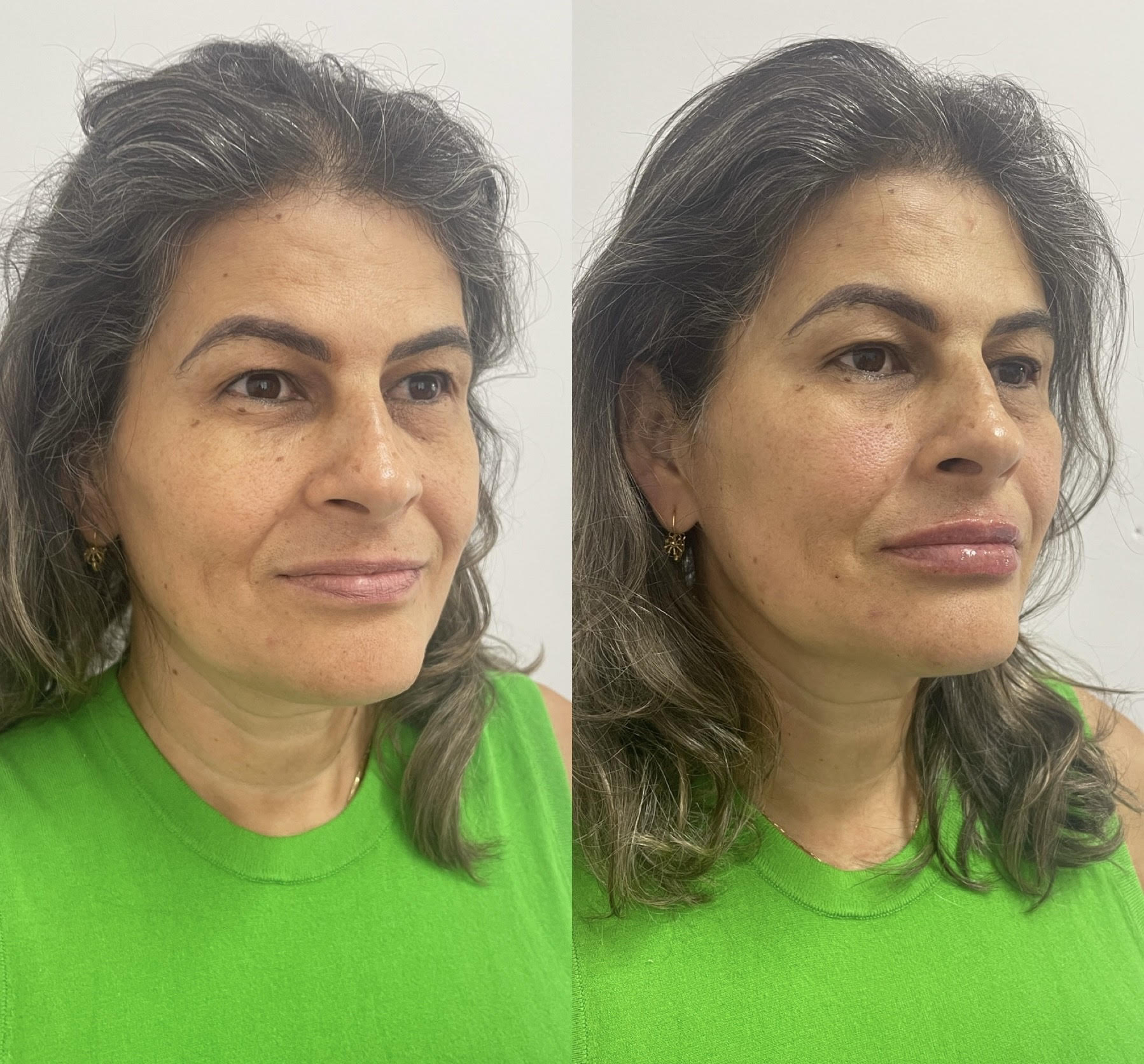 Resultado de Bioestimulador