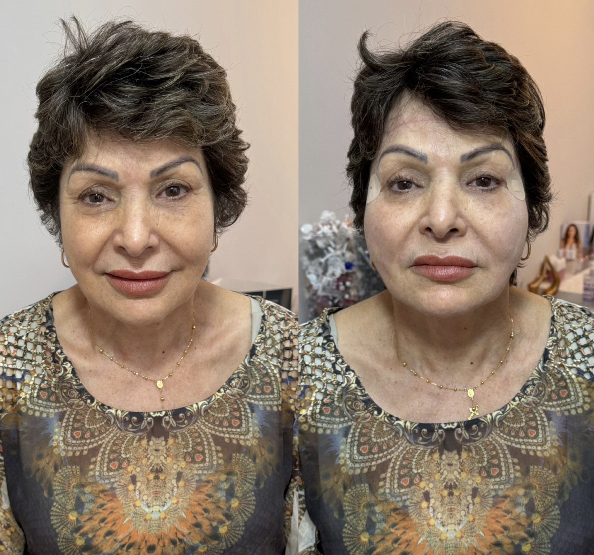 Resultado 1 de Fios de PDO