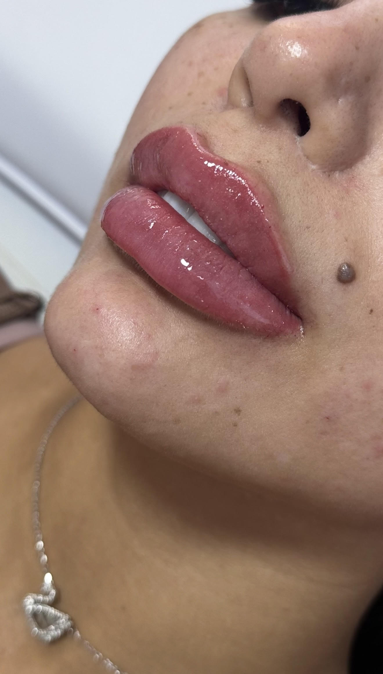 Resultado de Lábios